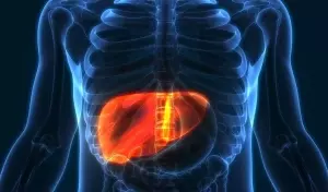 Understanding Fatty Liver: A Comprehensive Scientific Overview