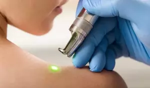How Laser Medical Devices Are Used in Treatment: A Technical Overview