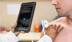 Portable Ultrasound Devices: A Technical and Clinical Overview