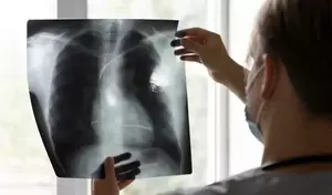 Pneumonia: A Comprehensive Technical and Biological Overview