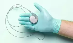 Cardiac Pacemakers: A Scientific Overview of Principles, Mechanisms, and Clinical Context