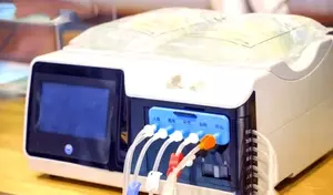 Dialysis Machines: Principles, Mechanisms, Clinical Applications, and Perspectives