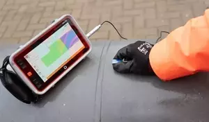 Ultrasound Equipment: Principles, Functions, and Clinical Applications