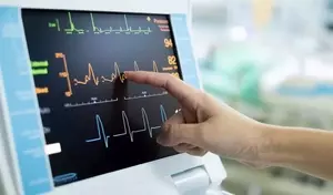 Electrocardiograph (ECG) Machines: Principles, Functionality, and Clinical Overview
