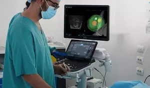 Ultrasound Diagnostic Systems: Principles, Imaging Mechanisms, and Clinical Interpretation