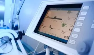 Mechanical Ventilators