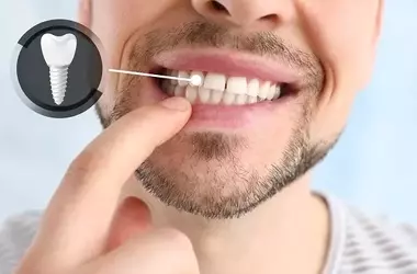 What Is the Best Age to Start Orthodontic Treatment?