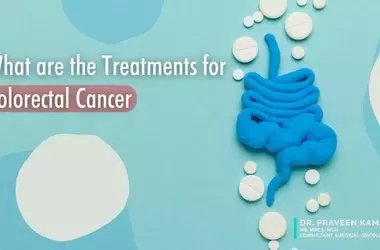 Colorectal Cancer Treatments: Recommendations from Oncologists