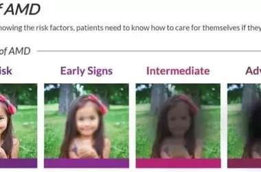 Comprehensive Guide to Macular Degeneration: Causes, Symptoms, and Treatment Options