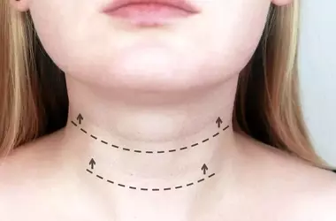 Simple Ways to Tighten Loose Neck Skin Naturally