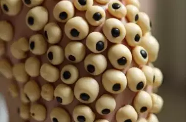 Natural and Safe Ways to Remove Skin Tags at Home