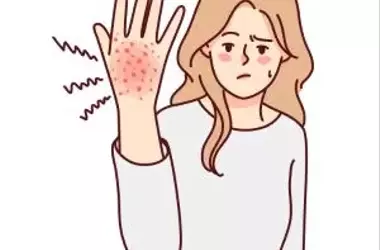 Are you itching to the point of collapse? Here is the 3-day eczema savior that can relieve itching