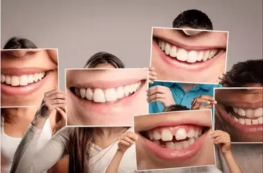 Missing a Tooth? You're Not Alone — Here's What People Are Doing About It