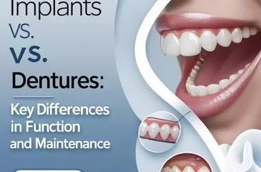Dental Implants vs. Dentures: Key Differences in Function and Maintenance