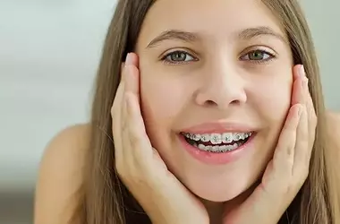 Zahnklammern für fehlende Zähne: Lösungen und Alternativen