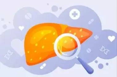 Understanding Fatty Liver Disease: Key Questions Answered
