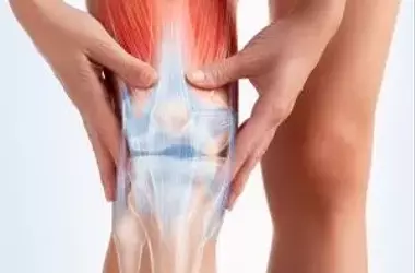 Knees are sounding the alarm – these signs may indicate arthritis