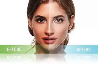 Photofacial: A Modern Solution for Skin Rejuvenation