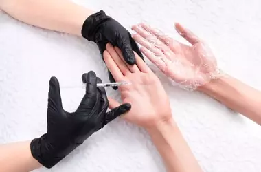 Iperidrosi: Un Approfondimento Completo su Cause, Sintomi e Strategie di Gestione