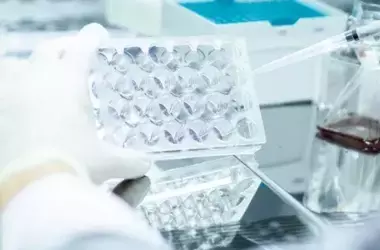 Saliva: Nuevo Aliado en el Pronóstico del Cáncer de Cabeza y Cuello