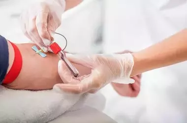 Sclerosi Multipla: La Rivoluzione della Diagnosi Precoce e le Nuove Frontiere Terapeutiche