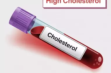 Signs for High Cholesterol: Alerts and Implications