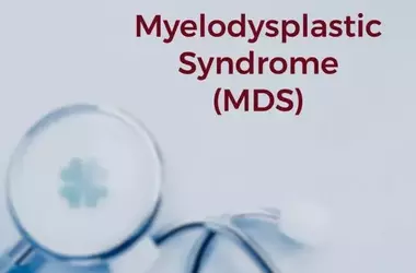 Understanding MDS Disease Treatment Options