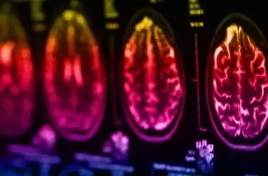 Brain Networks Decode Sound and Anticipate Auditory Sequences