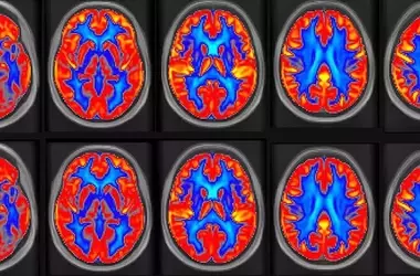 Peanut Consumption Boosts Brain Function and Memory in Older Adults