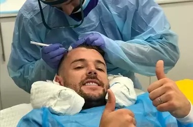 Complete Guide to Hair Transplant Clinics: From Diagnosing Hair Loss to Choosing Techniques