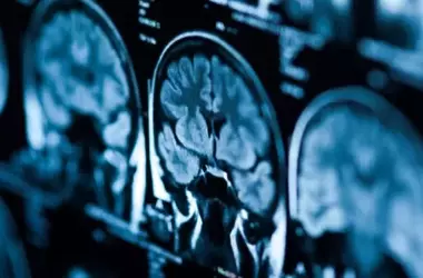 Mapping the Mind: How the Brain Processes Different Facets of Life Satisfaction