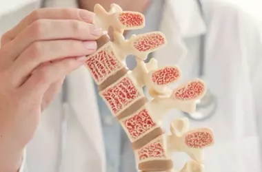 Understanding Osteoporosis: A Scientific and Technical Overview