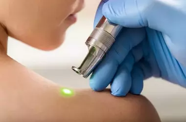 How Laser Medical Devices Are Used in Treatment: A Technical Overview