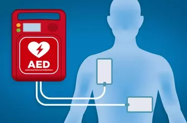 Automated External Defibrillators (AEDs): A Technical and Clinical Overview