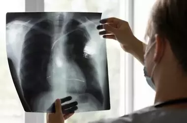 Pneumonia: A Comprehensive Technical and Biological Overview