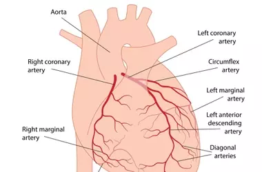 Understanding Coronary Artery Disease: A Comprehensive Scientific Overview