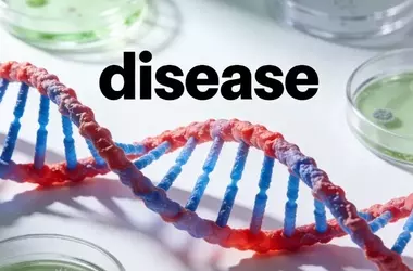 High Cholesterol: How It Affects Heart Health