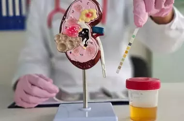 High Protein in Urine: Symptoms, Causes, and Control Tips