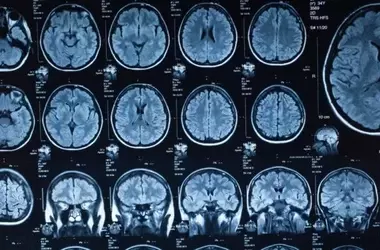 Scientists Uncover Five Distinct Phases of Brain Structural Development Across the Human Lifespan