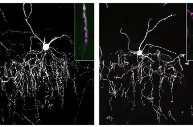 Brain's 'Orchestra Conductors' Precisely Connect to Target Cells Through Protein Interaction