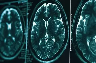 New Brain Activity Maps Challenge Century-Old Anatomical Boundaries