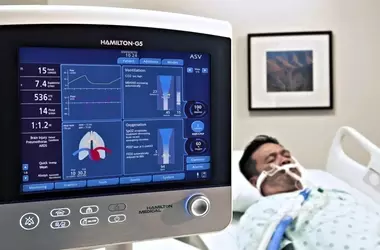 Mechanical Ventilators: A Scientific Overview of Principles, Functions, and Clinical Context