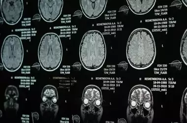 Bilingualism and Brain Aging: A New Perspective