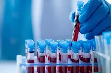 Blood Test Shows Promise for Early Parkinson's Detection