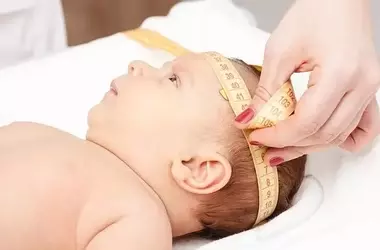 Infant Head Circumference Trajectories and Autism Risk: A Longitudinal Study