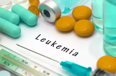 Navigating Leukemia Treatment in the U.S.: Modern Strategies and Personalized Care