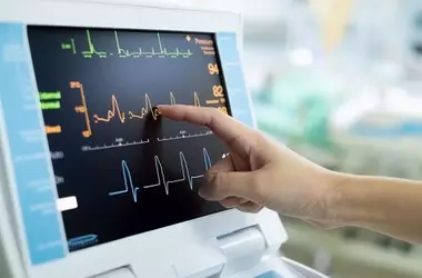 Electrocardiograph (ECG) Machines: Principles, Functionality, and Clinical Overview