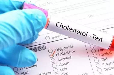 Nuove Linee Guida: Inizio Precoce della Terapia Anticolesterolo a 30 Anni