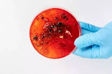 Sindrome Invisibile: La Sepsi e le Nuove Strategie Terapeutiche