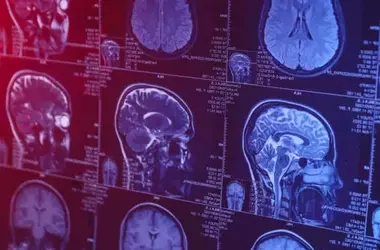 Smartphone Use Linked to Brain Changes